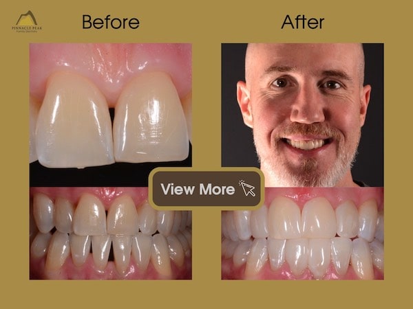 View More BIOCLEAR
