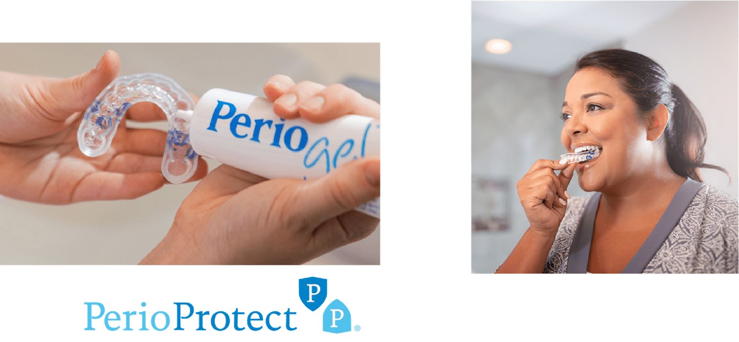 PerioProtect trays and gel