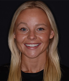 Pinnacle Peak Family Dentistry dental assistant, Cassie Harten.